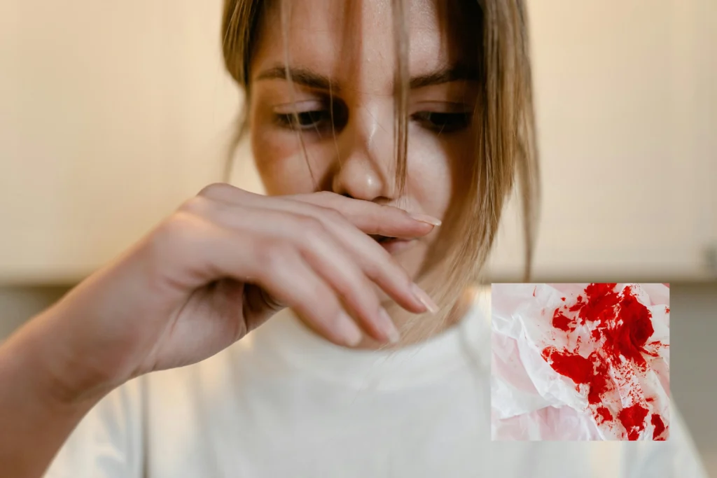 Trattamento di Emottisi con Radiologia Interventistica: Soluzioni Mininvasive per Sanguinamento Polmonare Ragazza con sanguinamento polmonare (emottisi) trattata con radiologia interventistica per fermare il sanguinamento bronchiale