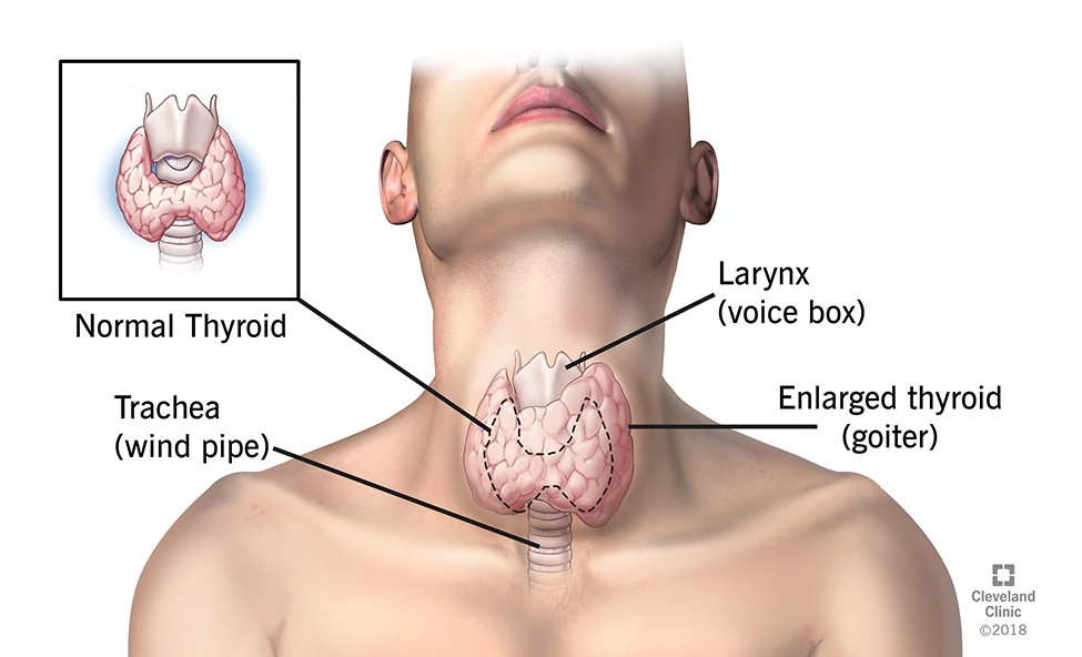 Anatomia della tiroide con indicazione sui noduli tiroidei e la loro localizzazione