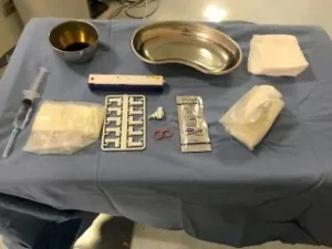 Esecuzione della biopsia percutanea sotto guida ecografica per prelevare campioni di tessuto.