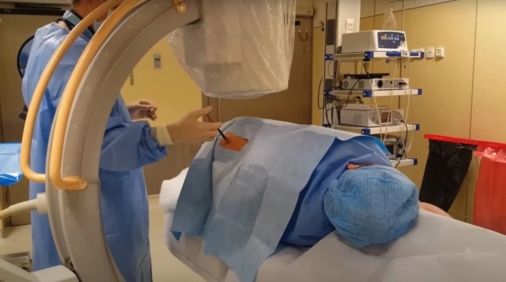 Trattamento percutaneo dell'ernia discale con Discogel in sala operatoria