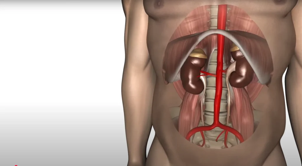 Embolizzazione endoleak tipo I sotto guida radiologica per trattare un'anomalia post-implantazione