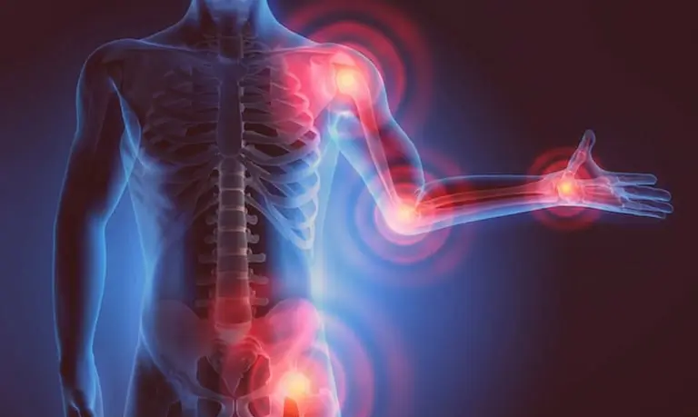 Trattamento del dolore articolare con tecniche di radiologia interventistica per il sollievo a lungo termine.