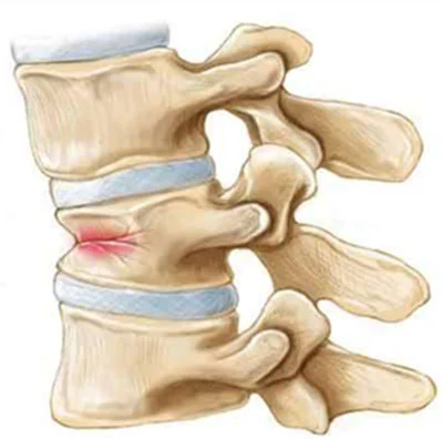 Radiologo esamina immagini per la diagnosi di frattura con radiologia interventistica