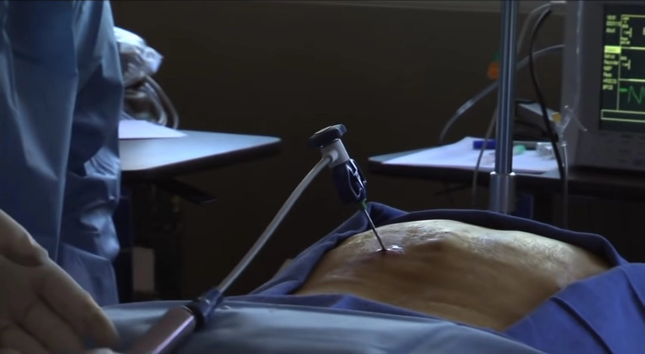 vertebroplastica-policlicnico